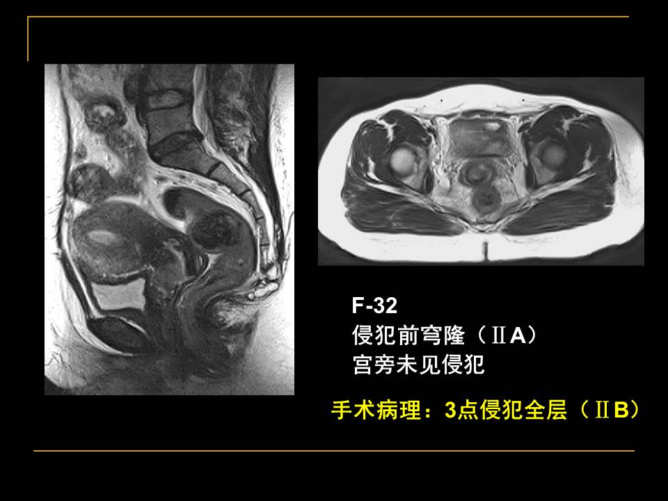 幻灯片35
