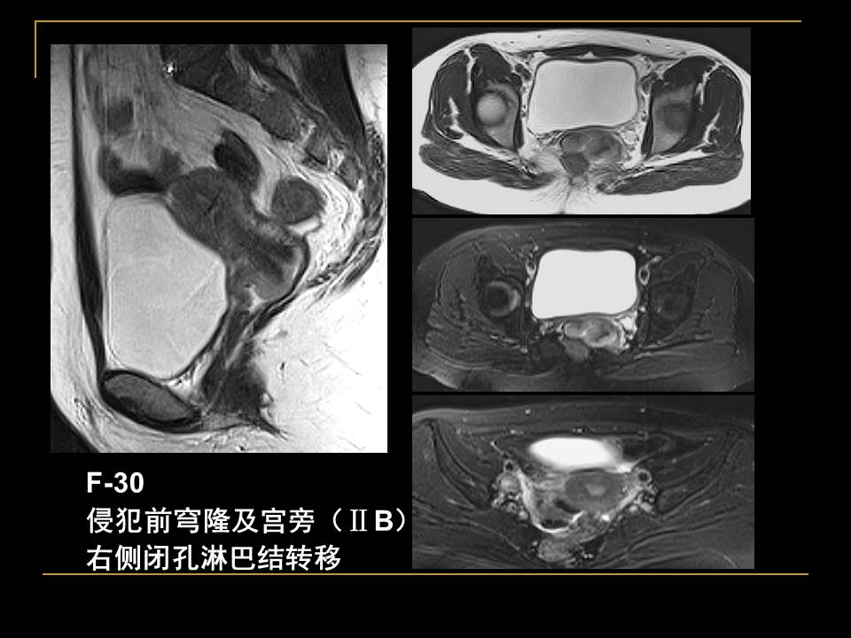 幻灯片36