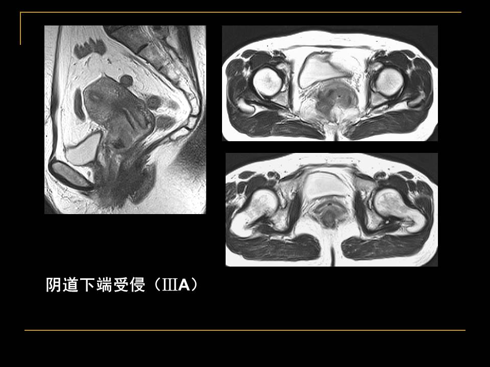 幻灯片39