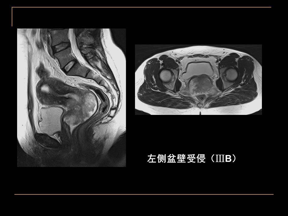 幻灯片40