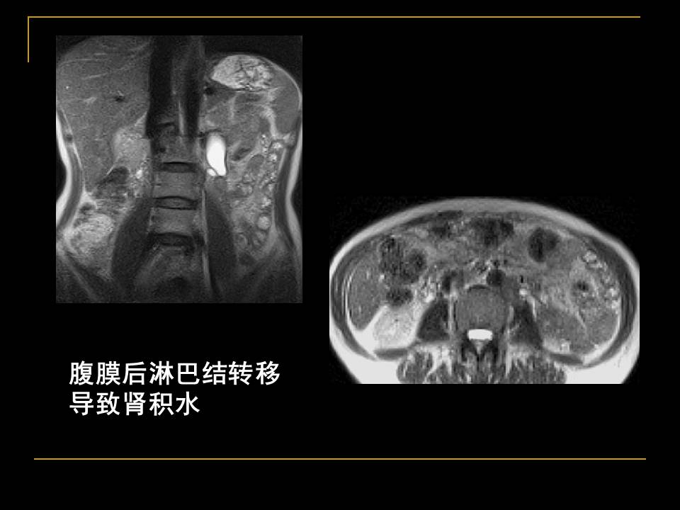 幻灯片43
