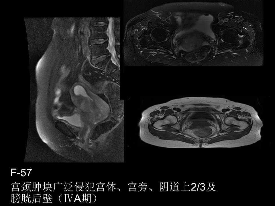 幻灯片46