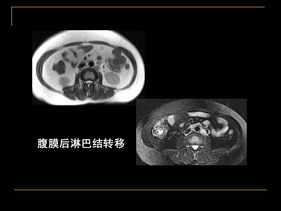幻灯片52