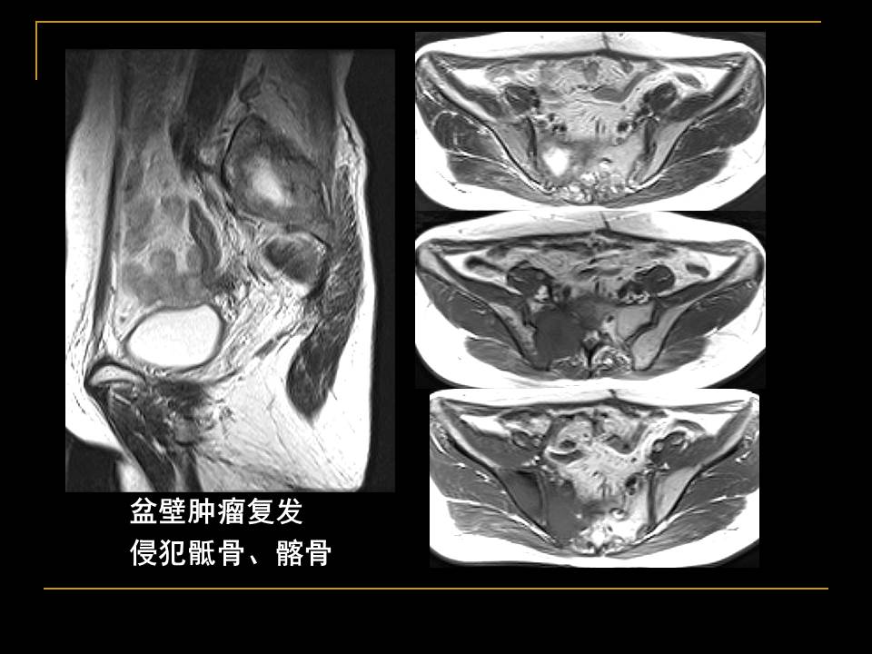 幻灯片58