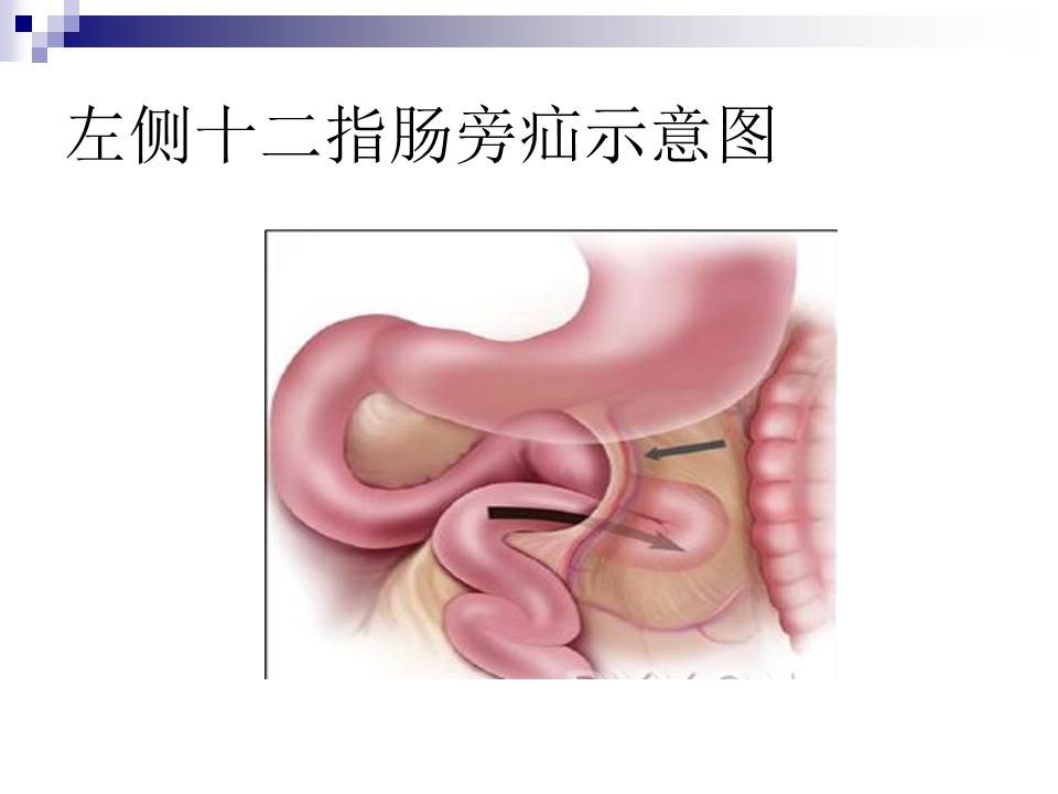 幻灯片9