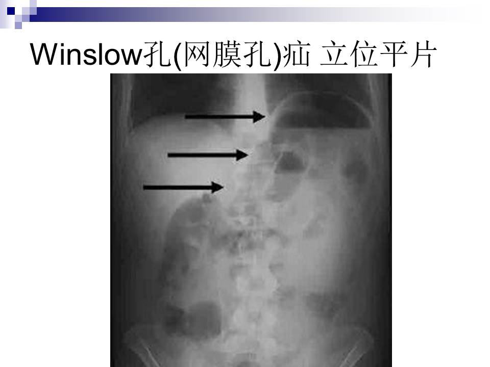 幻灯片26