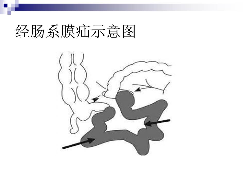 幻灯片32