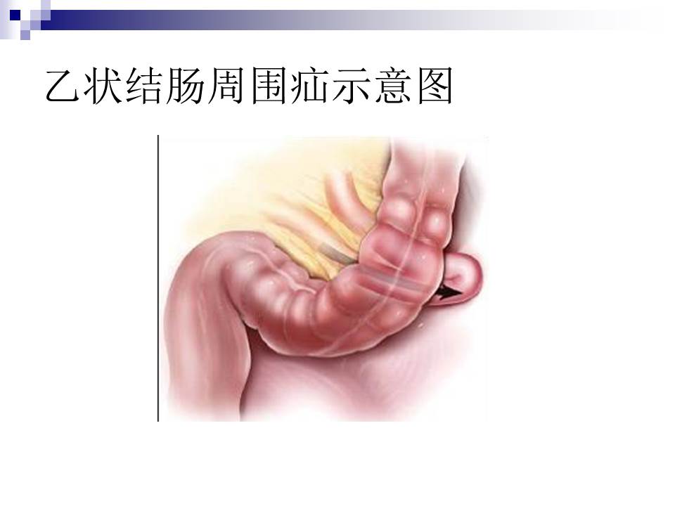 幻灯片37