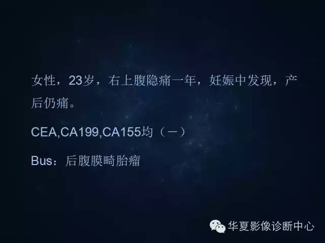 【病例】腹膜后间叶性软骨肉瘤1例CT影像表现