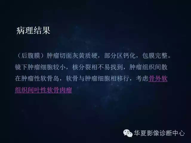 【病例】腹膜后间叶性软骨肉瘤1例CT影像表现