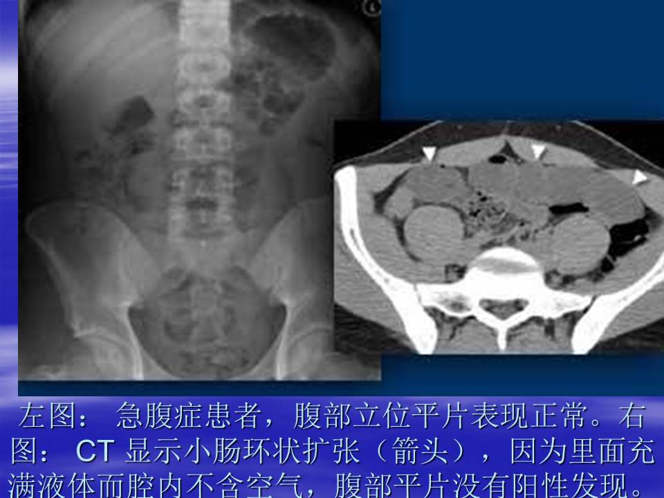 幻灯片11