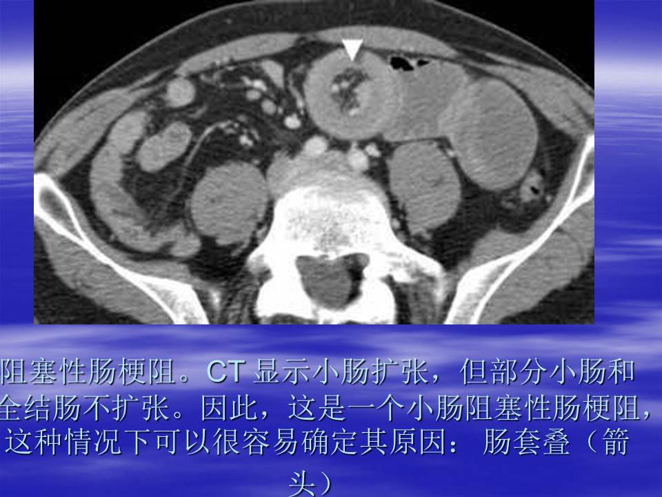 幻灯片48