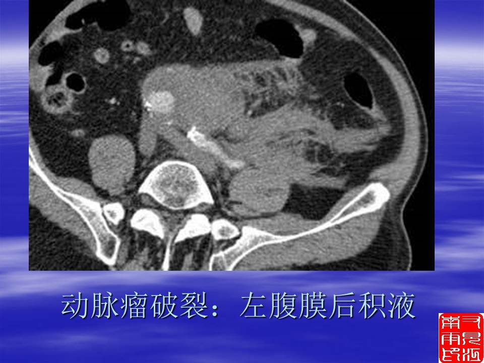 幻灯片74