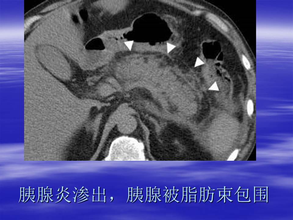 幻灯片76