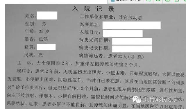 【病例】骶骨神经纤维瘤一例CT影像表现