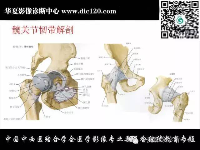 【PPT】髋关节常见疾病影像学诊断