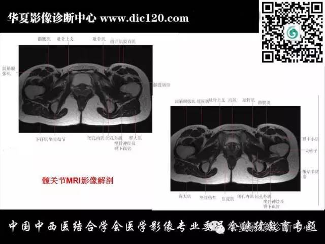 【PPT】髋关节常见疾病影像学诊断