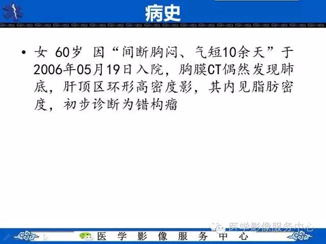 【病例】肝区异位节育器1例CT