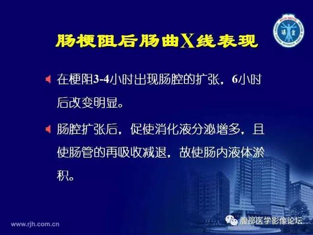 【PPT】急腹症
