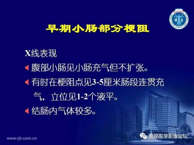 【PPT】急腹症