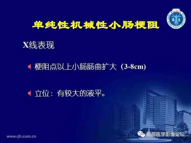 【PPT】急腹症