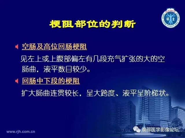 【PPT】急腹症