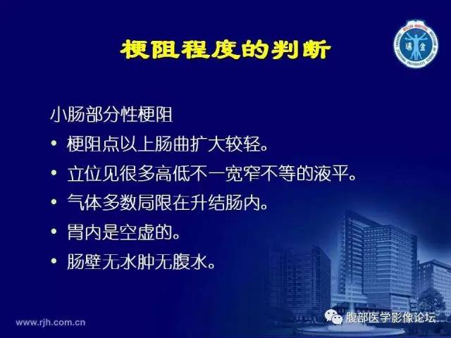 【PPT】急腹症