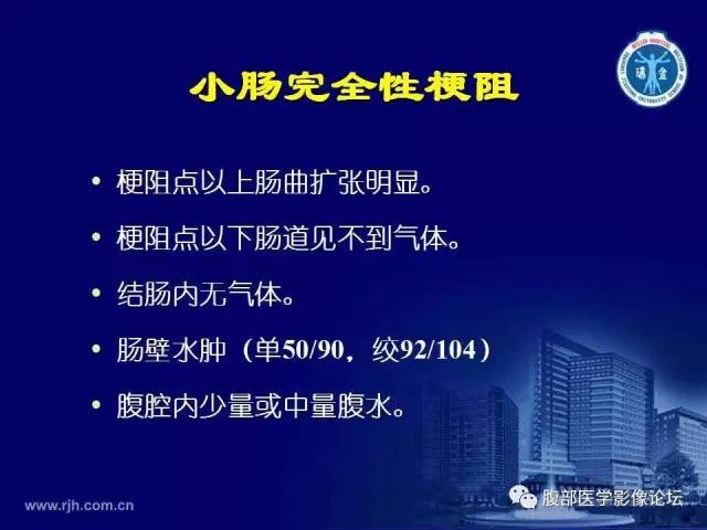 【PPT】急腹症