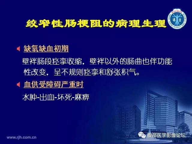 【PPT】急腹症