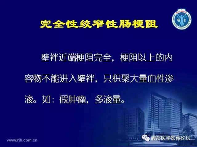 【PPT】急腹症