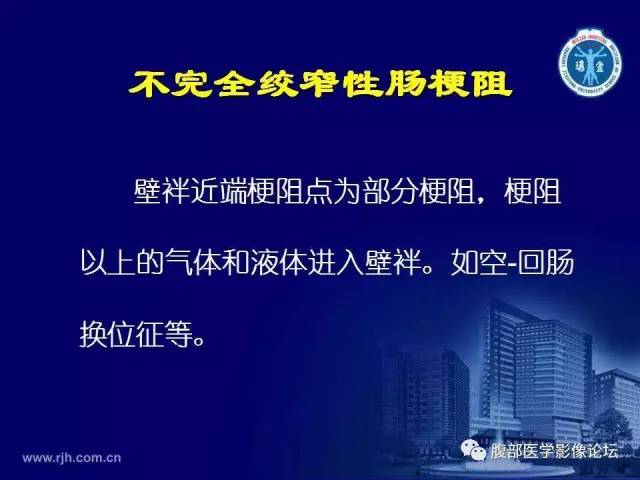 【PPT】急腹症