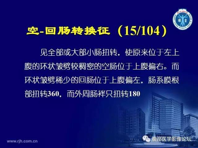 【PPT】急腹症