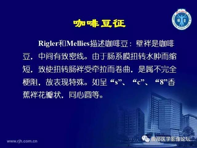 【PPT】急腹症