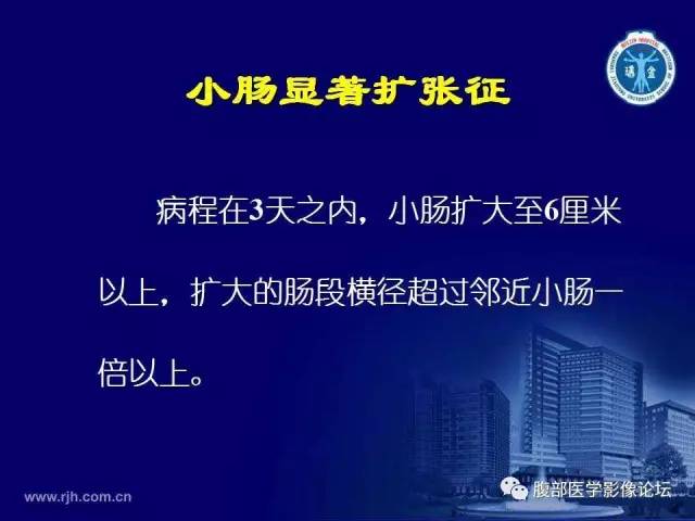 【PPT】急腹症