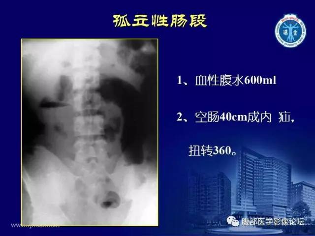 【PPT】急腹症