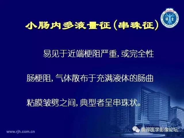 【PPT】急腹症