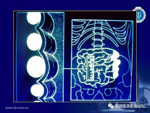 【PPT】急腹症
