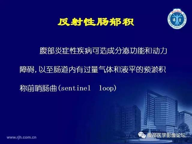 【PPT】急腹症