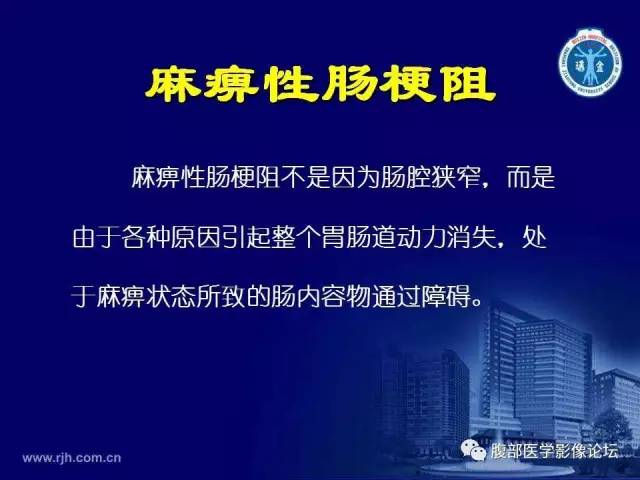 【PPT】急腹症