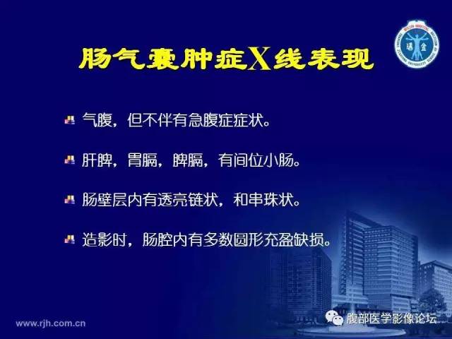 【PPT】急腹症