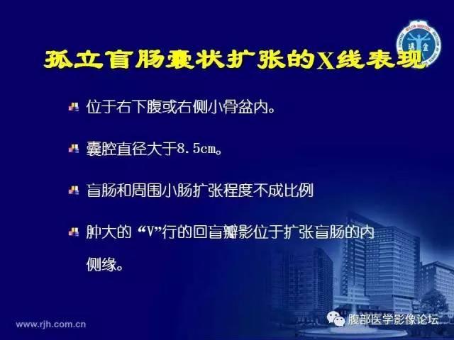 【PPT】急腹症