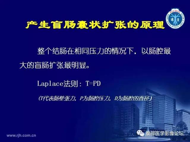 【PPT】急腹症