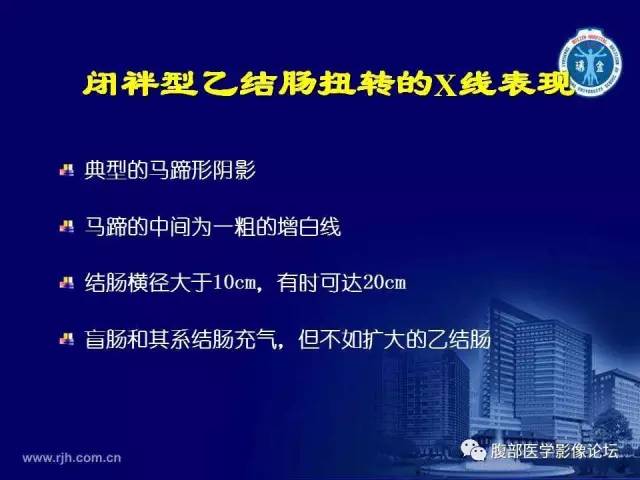【PPT】急腹症