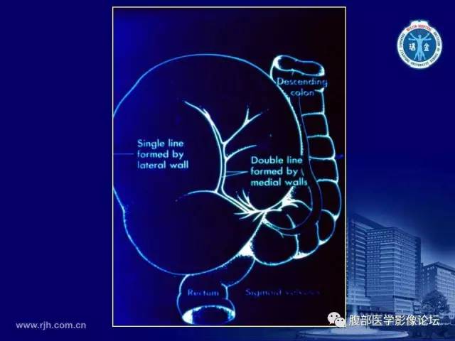 【PPT】急腹症