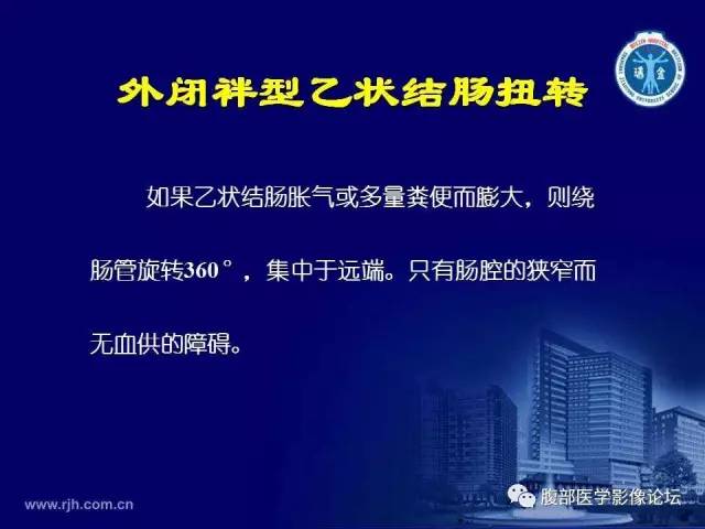 【PPT】急腹症