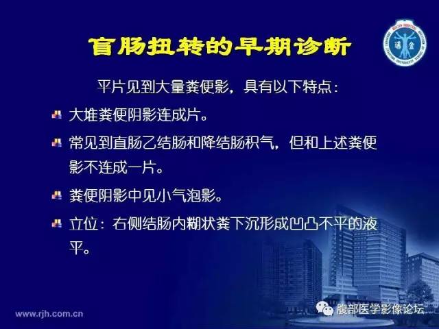 【PPT】急腹症