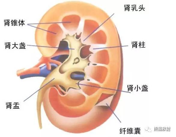 【双语病例】髓质海绵肾1例X线及CT鉴别诊断