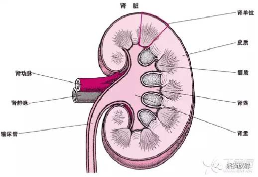 【双语病例】髓质海绵肾1例X线及CT鉴别诊断