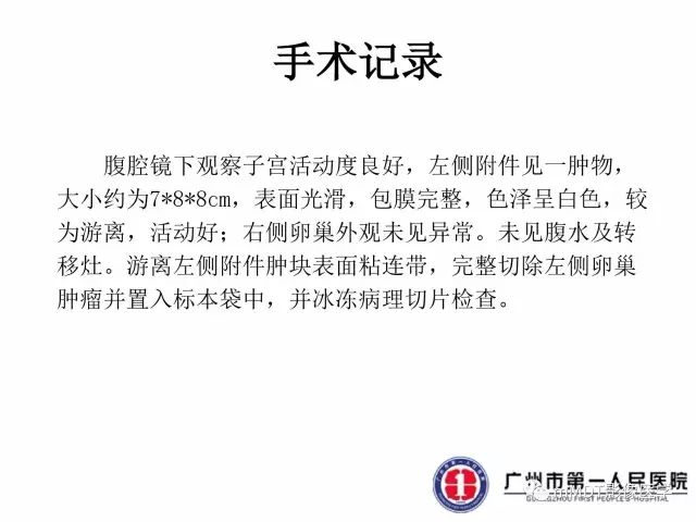 【病例】卵巢硬化性间质瘤1例MR