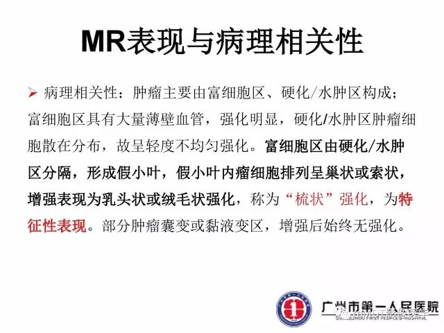 【病例】卵巢硬化性间质瘤1例MR